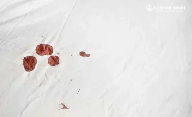 Kiểm tra và xác định vết máu trên nệm trước khi tiến hành vệ sinh